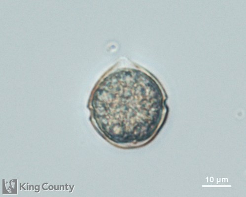 Photo of Scrippsiella trochoidea